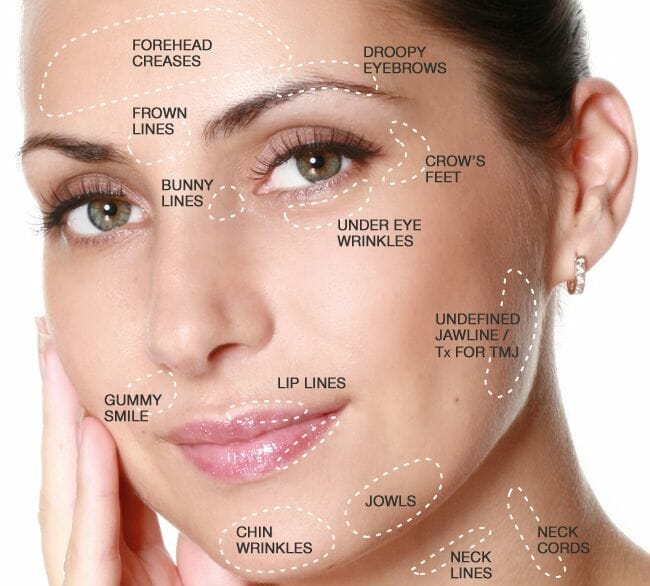 wrinkle zones wrinkle zones